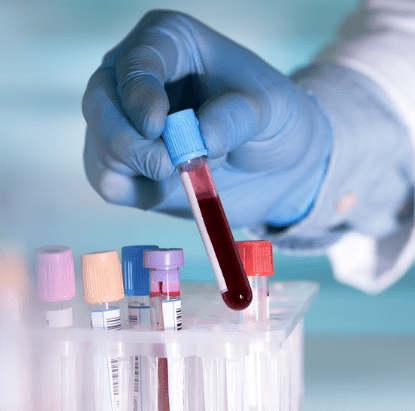 Especialista sosteniendo un tubo de ensayo lleno de sangre